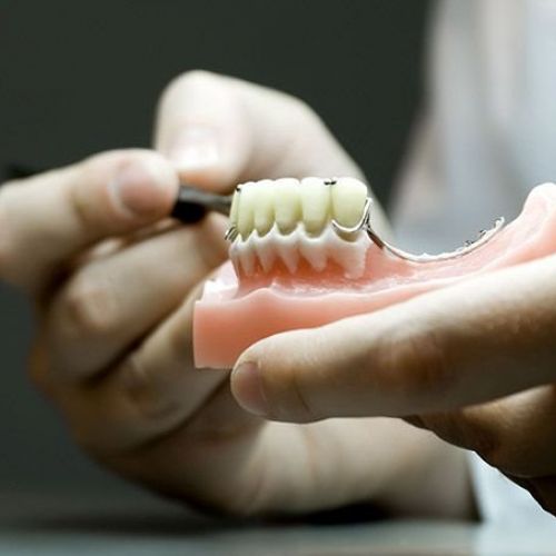 prótesis dentales en Sabadell
