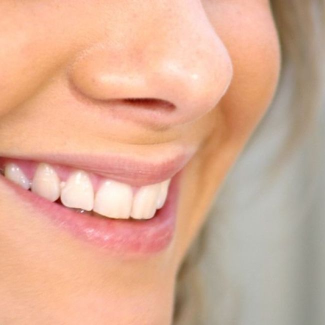  implantes dentales Sabadell