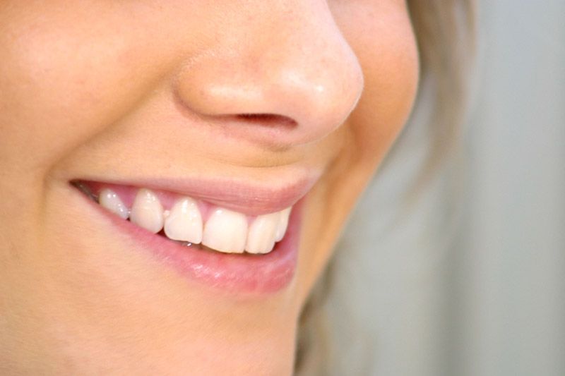  implantes dentales Sabadell