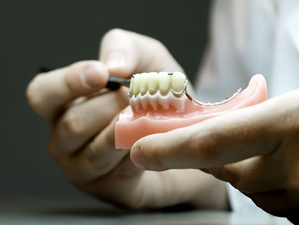 pròtesis dentals Sabadell